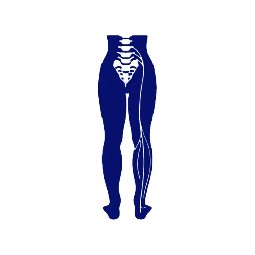 Sciatica Treatment in Gachibowli, Hyderabad.